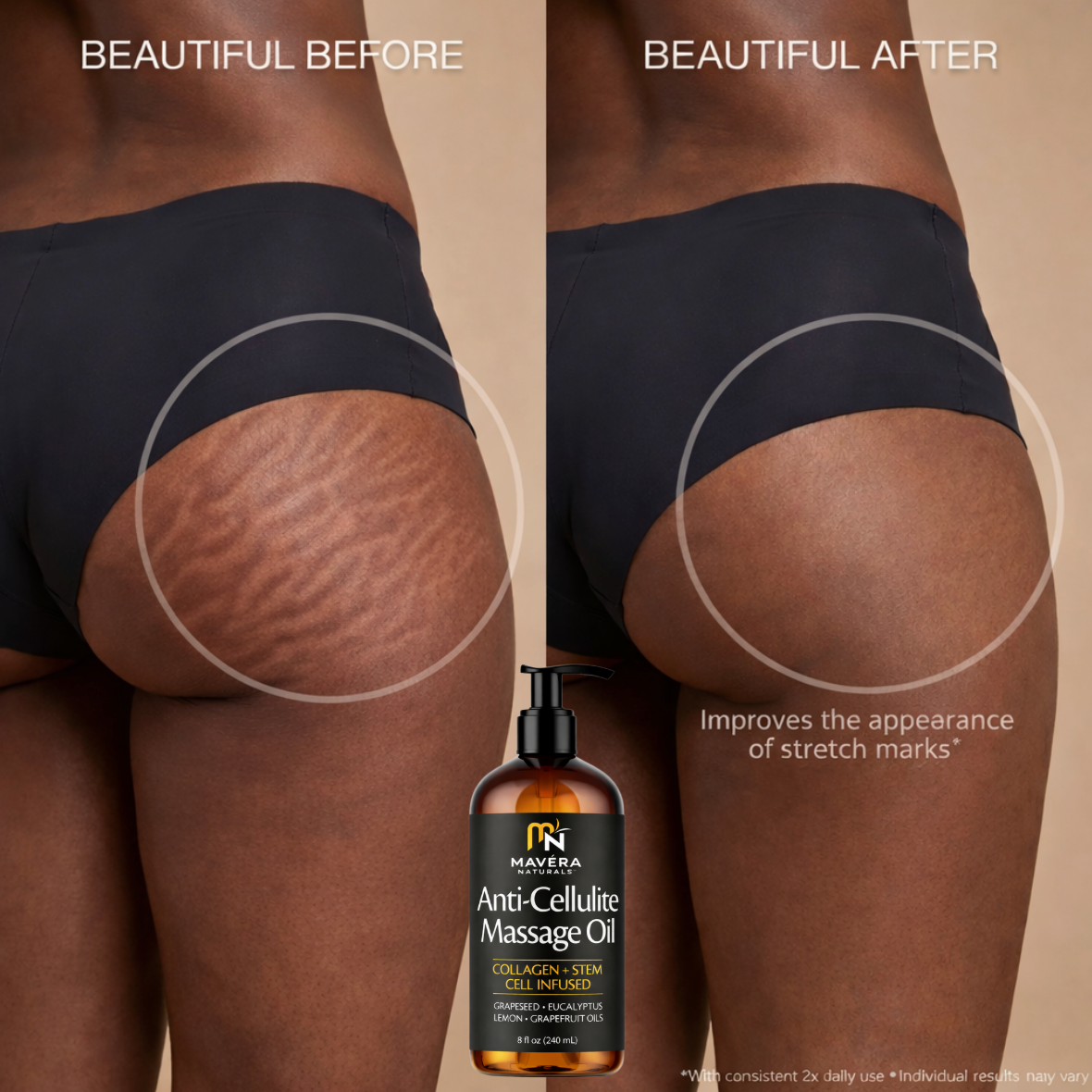 Anti-Cellulite Massage Oil